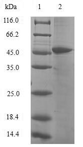 Human N6AMT1 protein