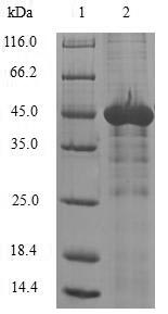 Human NAA50 protein
