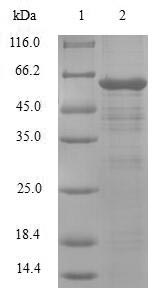 Human PDLIM1 protein