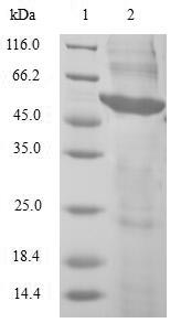 Human PRKAB2 protein
