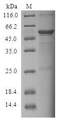 Human CIDEC protein