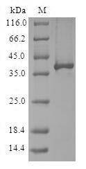 Human RBX1 protein