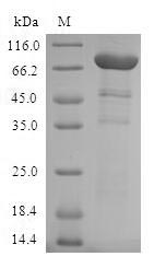 Human AIPL1 protein