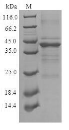 Human CPLX2 protein