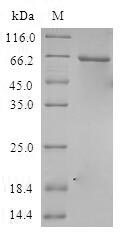 Human CSNK1A1L protein