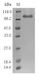 Human SETDB1 protein