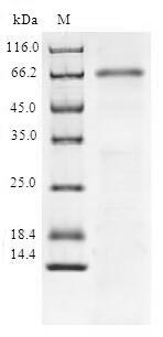 Human SIRT6 protein