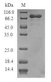 Human ADAP1 protein