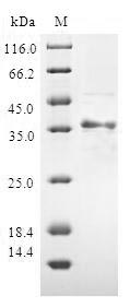 Human ATP5J protein