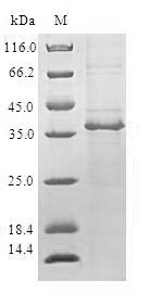 Human CROT protein