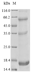 Human SSNA1 protein