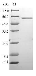 Human XRCC4 protein