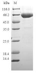 Human ADH1C protein