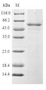Human BCAS2 protein