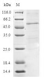 Human TIMM21 protein