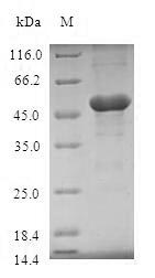 Human TICAM2 protein
