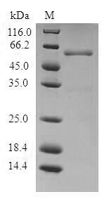 Human Interferon gamma protein