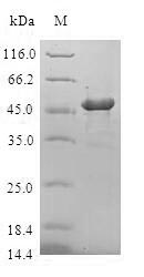Human CRYGD protein