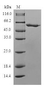 Human SLC25A20 protein