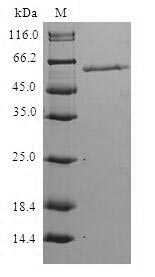 Human HPS1 protein
