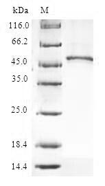 Human RPL9 protein
