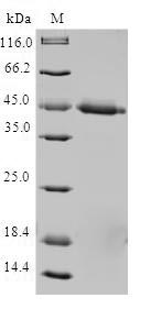 Human TIMM17A protein