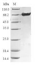 Human TMOD4 protein