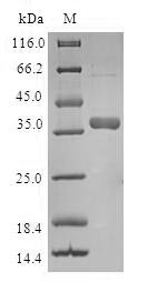 Human TIMM8A protein