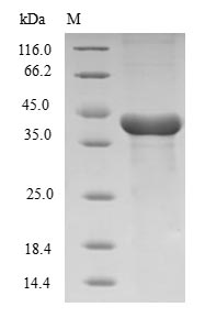 Human HIST1H3D protein