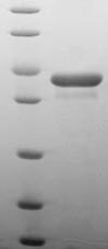 Human PDCD5 protein