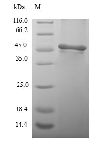 Human PSMB3 protein