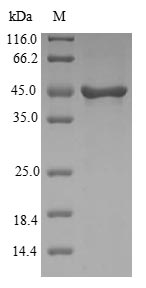 Human VSNL1 protein