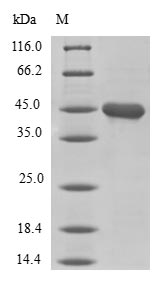 Human LMO4 protein