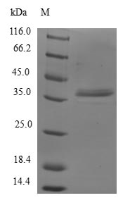 Human GTF2A2 protein