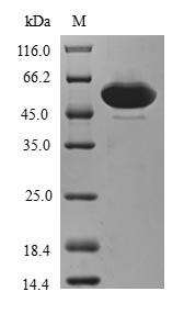 Human ZFAND3 protein