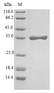 Human FXYD2 protein
