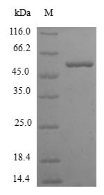 Human KHK protein