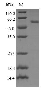 Human RAB23 protein
