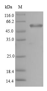 Human PHF11 protein
