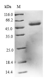 Human DCXR protein