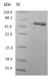 Human PSPH protein