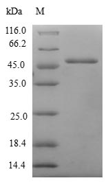 Human MSRB3 protein