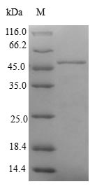 Human CBR4 protein
