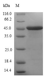 Human CETN1 protein