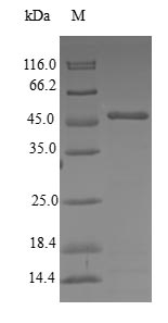 Human CETN3 protein