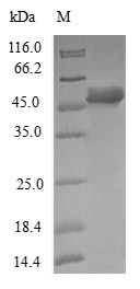 Human DCTN6 protein