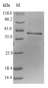 Human RPP25L protein