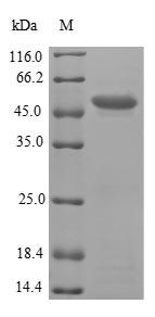 Human PMM2 protein