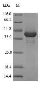 Human CBY1 protein