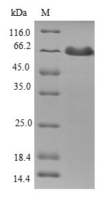 Human TMOD1 protein